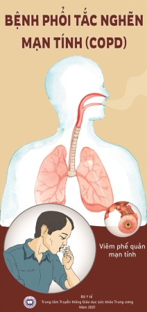 Bệnh phổi tắc nghẽn mạn tính (COPD)