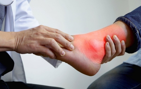 Bệnh Gout và những điều cần biết